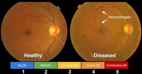 吃瓜群众人工智能实验